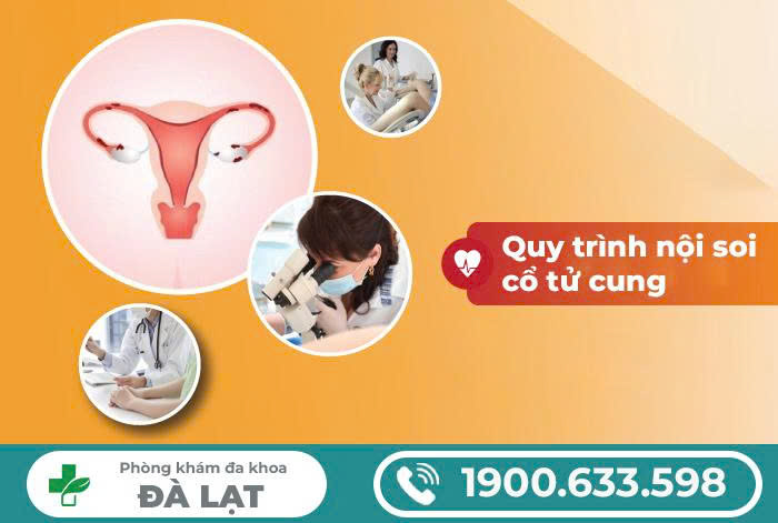 Hình ảnh minh họa